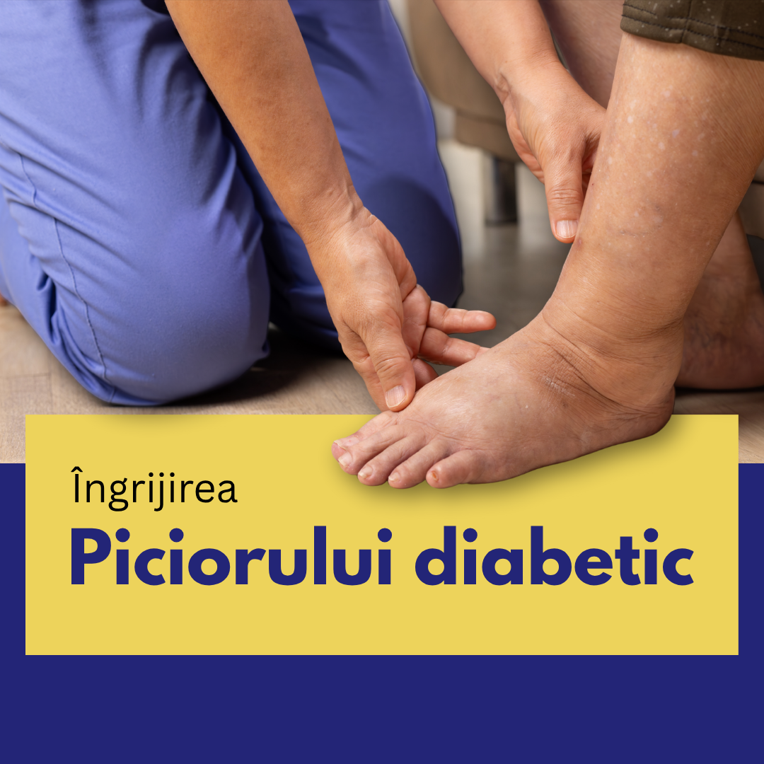 Piciorul diabetic - ce să știe persoanele cu DIABET Piciorul diabetic - ce să știe persoanele cu DIABET